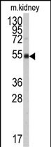WB - ALDH9A1 Antibody (N-term) AP7850a